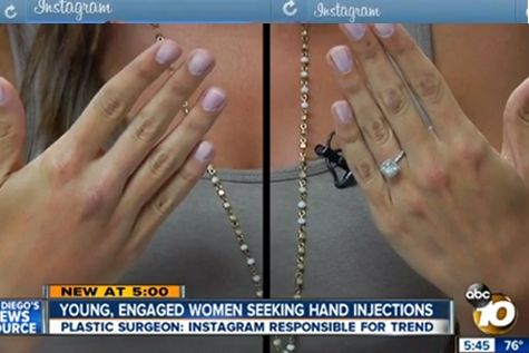 העולם השתגע: ניתוחים בשביל האינסטגרם 2